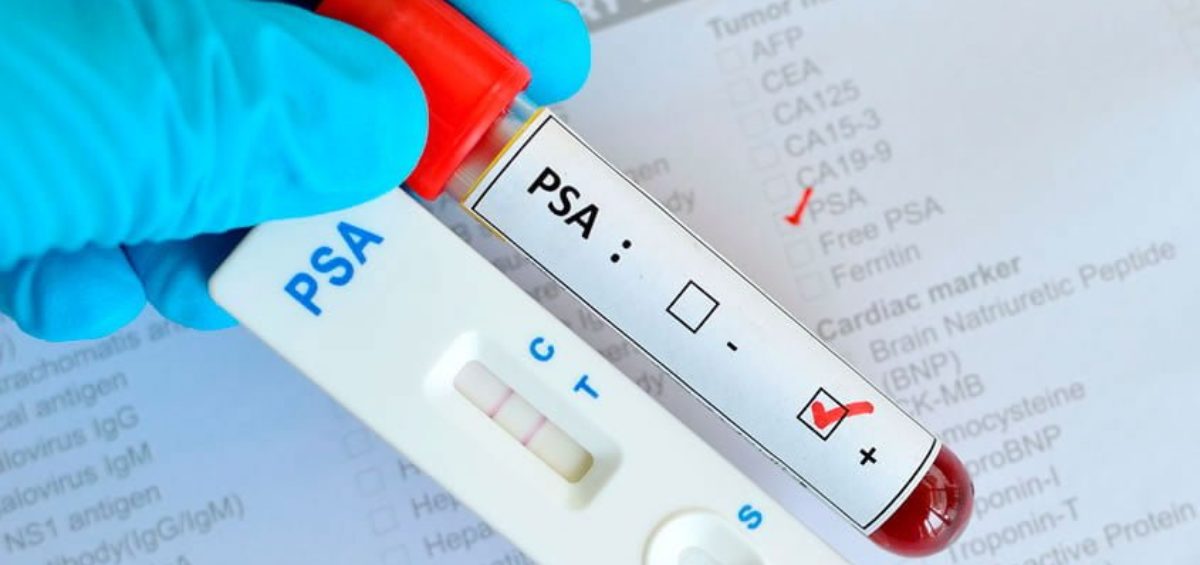 capsula-de-salud_que-es-una-prueba-de-PSA PSA