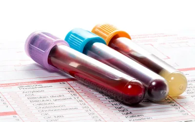 Blog 1 Nuevo servicio estudio genético del cáncer de próstata.